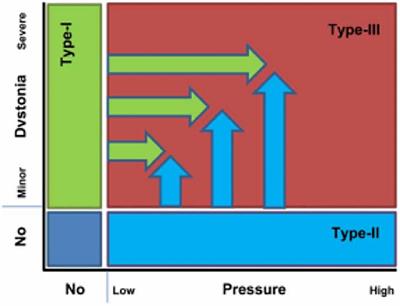 Personality Predictors of Yips and Choking Susceptibility